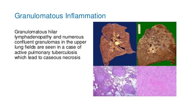 Inflammatory response to infection