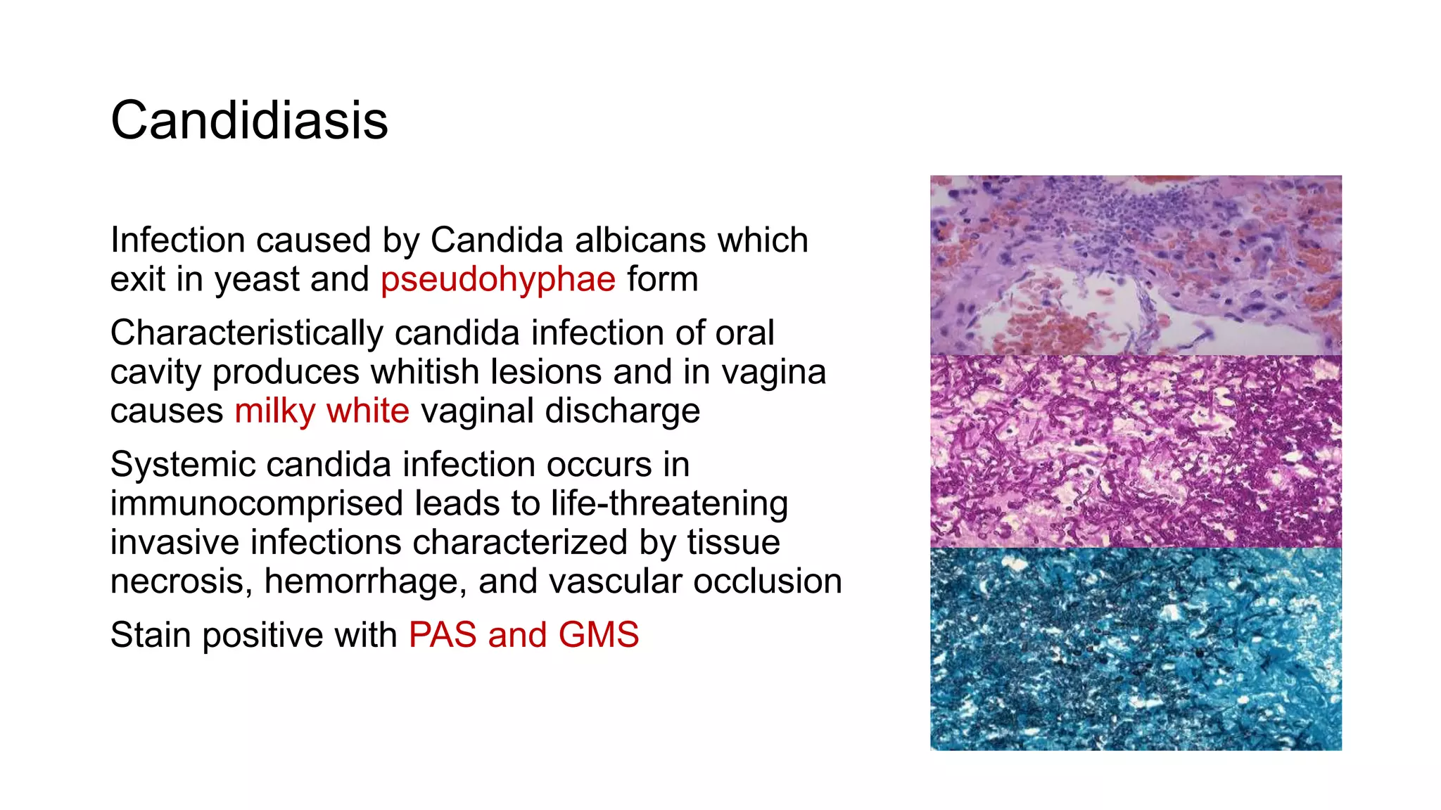 Fungal infections | PPTX