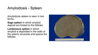 Amyloidosis - Spleen
Amyloidosis spleen is seen in two
forms;
Sago spleen in which amyloid
deposit are limited to the follicles
Lardaceous spleen in which
amyloid is deposited in the walls of
the splenic sinusoids and spares the
follicles
 