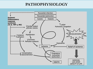 Lec 4 management of cardiogenic shock for mohs | PPTX