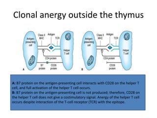 Clonal anergy outside the thymus
A: B7 protein on the antigen-presenting cell interacts with CD28 on the helper T
cell, and full activation of the helper T cell occurs.
B: B7 protein on the antigen-presenting cell is not produced; therefore, CD28 on
the helper T cell does not give a costimulatory signal. Anergy of the helper T cell
occurs despite interaction of the T-cell receptor (TCR) with the epitope.
 