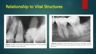 Relationship to Vital Structures
 