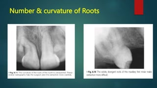 Number & curvature of Roots
 