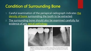 Condition of Surrounding Bone
1. Careful examination of the periapical radiograph indicates the
density of bone surrounding the tooth to be extracted.
2. The surrounding bone should also be examined carefully for
evidence of any apical pathology.
 