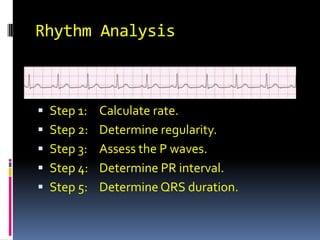 Rhythm Analysis Step 1:	Calculate rate. Step 2:	Determine regularity. Step 3:	Assess the P waves. Step 4:	Determine PR interval. Step 5:	Determine QRS duration. 