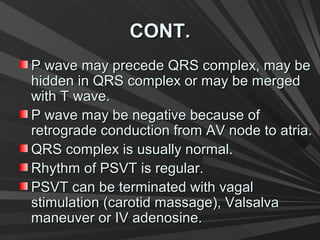 CONT.CONT.
P wave may precede QRS complex, may beP wave may precede QRS complex, may be
hidden in QRS complex or may be mergedhidden in QRS complex or may be merged
with T wave.with T wave.
P wave may be negative because ofP wave may be negative because of
retrograde conduction from AV node to atria.retrograde conduction from AV node to atria.
QRS complex is usually normal.QRS complex is usually normal.
Rhythm of PSVT is regular.Rhythm of PSVT is regular.
PSVT can be terminated with vagalPSVT can be terminated with vagal
stimulation (carotid massage), Valsalvastimulation (carotid massage), Valsalva
maneuver or IV adenosine.maneuver or IV adenosine.
 