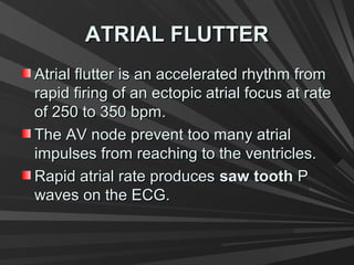ATRIAL FLUTTERATRIAL FLUTTER
Atrial flutter is an accelerated rhythm fromAtrial flutter is an accelerated rhythm from
rapid firing of an ectopic atrial focus at raterapid firing of an ectopic atrial focus at rate
of 250 to 350 bpm.of 250 to 350 bpm.
The AV node prevent too many atrialThe AV node prevent too many atrial
impulses from reaching to the ventricles.impulses from reaching to the ventricles.
Rapid atrial rate producesRapid atrial rate produces saw toothsaw tooth PP
waves on the ECG.waves on the ECG.
 