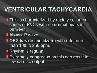 VENTRICULAR TACHYCARDIAVENTRICULAR TACHYCARDIA
This is characterized by rapidly occurringThis is characterized by rapidly occurring
series of PVCs with no normal beats inseries of PVCs with no normal beats in
between.between.
Absent P wave.Absent P wave.
QRS is wide and bizarre with rate moreQRS is wide and bizarre with rate more
than 100 to 250 bpm.than 100 to 250 bpm.
Rhythm is regular.Rhythm is regular.
Extremely dangerous as this can result inExtremely dangerous as this can result in
low cardiac output.low cardiac output.
 