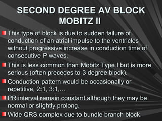 SECOND DEGREE AV BLOCKSECOND DEGREE AV BLOCK
MOBITZ IIMOBITZ II
This type of block is due to sudden failure ofThis type of block is due to sudden failure of
conduction of an atrial impulse to the ventriclesconduction of an atrial impulse to the ventricles
without progressive increase in conduction time ofwithout progressive increase in conduction time of
consecutive P waves.consecutive P waves.
This is less common than Mobitz Type I but is moreThis is less common than Mobitz Type I but is more
serious (often precedes to 3 degree block).serious (often precedes to 3 degree block).
Conduction pattern would be occasionally orConduction pattern would be occasionally or
repetitive, 2:1, 3:1,…repetitive, 2:1, 3:1,…
PR interval remain constant although they may bePR interval remain constant although they may be
normal or slightly prolong.normal or slightly prolong.
Wide QRS complex due to bundle branch block.Wide QRS complex due to bundle branch block.
 
