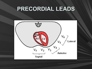 PRECORDIAL LEADSPRECORDIAL LEADS
 