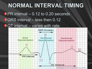 NORMAL INTERVAL TIMINGNORMAL INTERVAL TIMING
PR interval – 0.12 to 0.20 secondsPR interval – 0.12 to 0.20 seconds
QRS interval – less then 0.12QRS interval – less then 0.12
QT interval – varies with rate.QT interval – varies with rate.
 