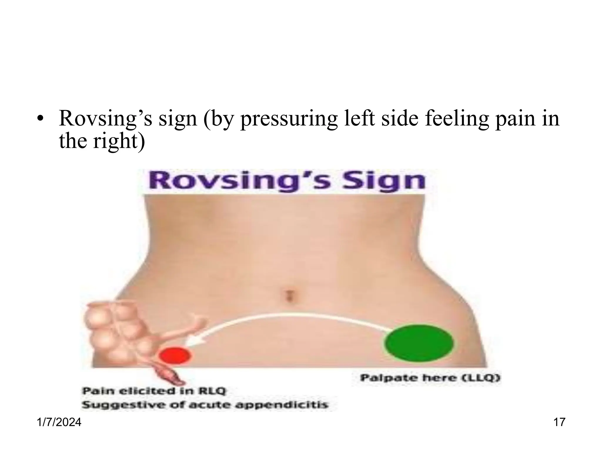 Lec # 5 Disorders of small & large Intestine.ppt