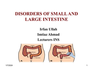 DISORDERS OF SMALLAND
LARGE INTESTINE
Irfan Ullah
Imtiaz Ahmad
Lecturers INS
1/7/2024 1
 