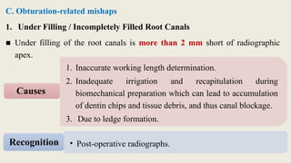 C. Obturation-related mishaps
1. Under Filling / Incompletely Filled Root Canals
■ Under filling of the root canals is more than 2 mm short of radiographic
apex.
1. Inaccurate working length determination.
2. Inadequate irrigation and recapitulation during
biomechanical preparation which can lead to accumulation
of dentin chips and tissue debris, and thus canal blockage.
3. Due to ledge formation.
Causes
• Post-operative radiographs.
Recognition
 