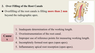 2. Over Filling of the Root Canals
■ Overfilling of the root canals is filling more than 2 mm
beyond the radiographic apex.
1. Inadequate determination of the working length.
2. Overinstrumentation of the root canal.
3. Improper use of reference points for measuring working length.
4. Incompletely formed root apex (open apex).
5. Inflammatory apical root resorption (open apex).
Cause
s
 