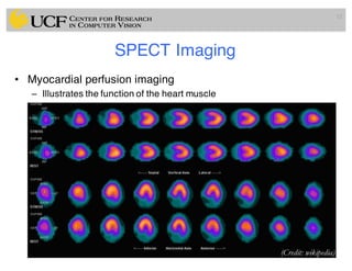 SPECT Imaging
• Myocardial perfusion imaging
– Illustrates the function of the heart muscle
12
(Credit: wikipedia)
 