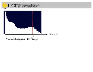 21
SUV scale
2.5
A sample histogram – PET image
 