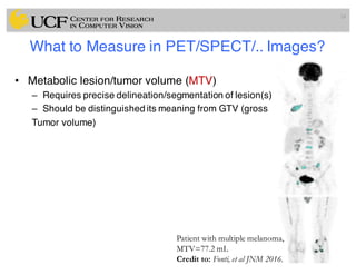 What to Measure in PET/SPECT/.. Images?
• Metabolic lesion/tumor volume (MTV)
– Requires precise delineation/segmentation of lesion(s)
– Should be distinguished its meaning from GTV (gross
Tumor volume)
24
Patient with multiple melanoma,
MTV=77.2 mL
Credit to: Fonti, et al JNM 2016.
 