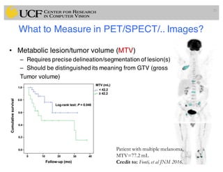 What to Measure in PET/SPECT/.. Images?
• Metabolic lesion/tumor volume (MTV)
– Requires precise delineation/segmentation of lesion(s)
– Should be distinguished its meaning from GTV (gross
Tumor volume)
25
Patient with multiple melanoma,
MTV=77.2 mL
Credit to: Fonti, et al JNM 2016.
 