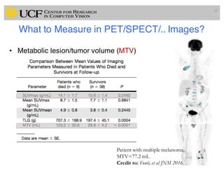 What to Measure in PET/SPECT/.. Images?
• Metabolic lesion/tumor volume (MTV)
26
Patient with multiple melanoma,
MTV=77.2 mL
Credit to: Fonti, et al JNM 2016.
 