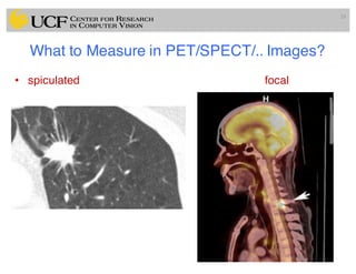 What to Measure in PET/SPECT/.. Images?
• spiculated focal
28
 