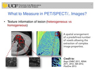 What to Measure in PET/SPECT/.. Images?
• Texture information of lesion (heterogeneous vs
homogeneous)
32
A spatial arrangement
of a predefined number
of voxels allowing the
extraction of complex
image properties.
Credit to:
Bagci EMBC 2011, RSNA
2011, 2012, ISBI 2012,
PlosOne 2013.
 