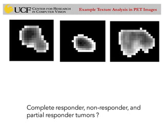 Complete responder, non-responder, and
partial responder tumors ?
Example Texture Analysis in PET Images
 