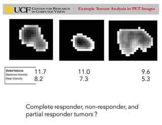 11.7 11.0 9.6
8.2 7.3 5.3
Complete responder, non-responder, and
partial responder tumors ?
Example Texture Analysis in PET Images
 