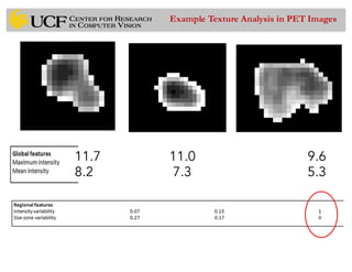 Example Texture Analysis in PET Images
11.7 11.0 9.6
8.2 7.3 5.3
 
