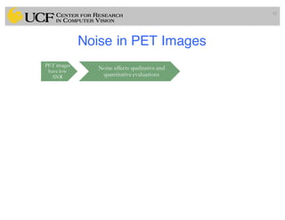 Noise in PET Images
42
PET images
have low
SNR
Noise affects qualitative and
quantitative evaluations
 