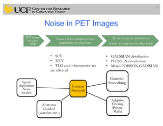 Noise in PET Images
46
PET images
have low
SNR
Noise affects qualitative and
quantitative evaluations
To model noise distribution
Gauss. assumption is often made
• GAUSSIAN distribution
• POISSON distribution
• Mixed POISSON GAUSSIAN
• SUV
• MTV
• TLG and othermetrics are
are affected
Current
Methods
Gaussian
Smoothing
Adaptive
Filtering
(Perona-
Malik)
Anatomy
Guided
(wavelet,etc..)
Signal-
dependent
Noise
models
 