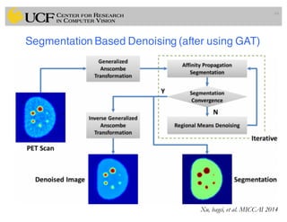 Segmentation Based Denoising (after using GAT)
64
Xu, bagci, et al. MICCAI 2014
 