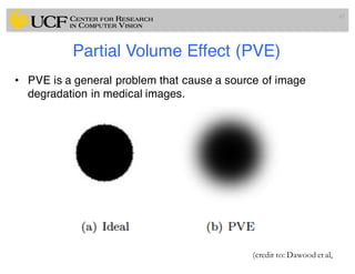 Partial Volume Effect (PVE)
• PVE is a general problem that cause a source of image
degradation in medical images.
67
(credit to: Dawood et al,
 