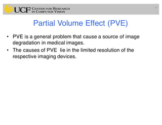 Partial Volume Effect (PVE)
• PVE is a general problem that cause a source of image
degradation in medical images.
• The causes of PVE lie in the limited resolution of the
respective imaging devices.
68
 