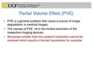 Partial Volume Effect (PVE)
• PVE is a general problem that cause a source of image
degradation in medical images.
• The causes of PVE lie in the limited resolution of the
respective imaging devices.
• Structures smaller than the system's resolution cannot be
resolved which results in blurred boundaries for example.
69
 