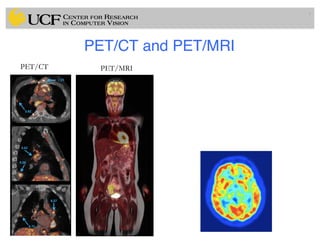 PET/CT and PET/MRI
7
PET/CT PET/MRI
 