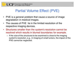 Partial Volume Effect (PVE)
• PVE is a general problem that cause a source of image
degradation in medical images.
• The causes of PVE lie in the limited resolution of the
respective imaging devices.
• Structures smaller than the system's resolution cannot be
resolved which results in blurred boundaries for example.
– If the size of the structures to be examined is close to the imaging
system's resolution, e.g., in imaging of small tumors, the impact of the
PVE cannot be neglected.
70
 