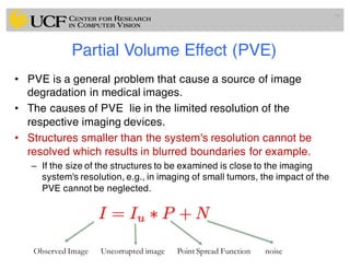Partial Volume Effect (PVE)
• PVE is a general problem that cause a source of image
degradation in medical images.
• The causes of PVE lie in the limited resolution of the
respective imaging devices.
• Structures smaller than the system's resolution cannot be
resolved which results in blurred boundaries for example.
– If the size of the structures to be examined is close to the imaging
system's resolution, e.g., in imaging of small tumors, the impact of the
PVE cannot be neglected.
71
Observed Image Uncorrupted image Point Spread Function noise
 