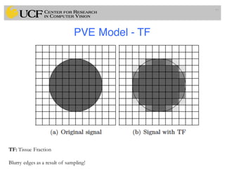 PVE Model - TF
77
TF: Tissue Fraction
Blurry edges as a result of sampling!
 