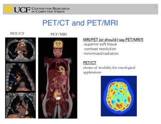 PET/CT and PET/MRI
8
PET/CT PET/MRI
MRI/PET (or should I say PET/MRI?)
-superior soft tissue
contrast resolution
-minimized radiation
PET/CT
choice of modality for oncological
applications
 