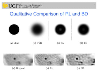 Qualitative Comparison of RL and BD
93
 