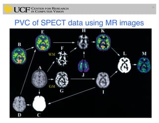 PVC of SPECT data using MR images
96
WM
GM
 
