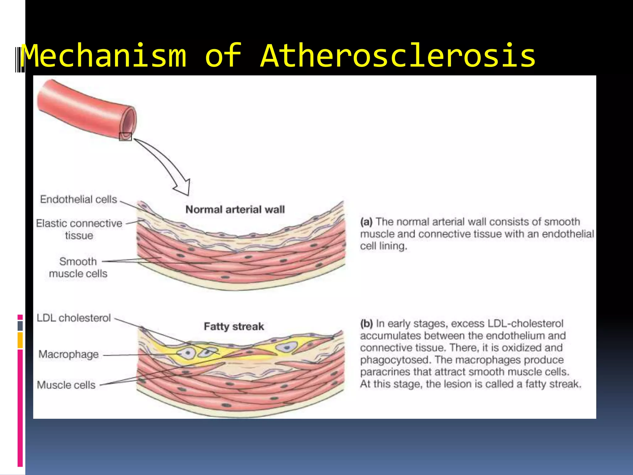 Mechanism of Atherosclerosis
