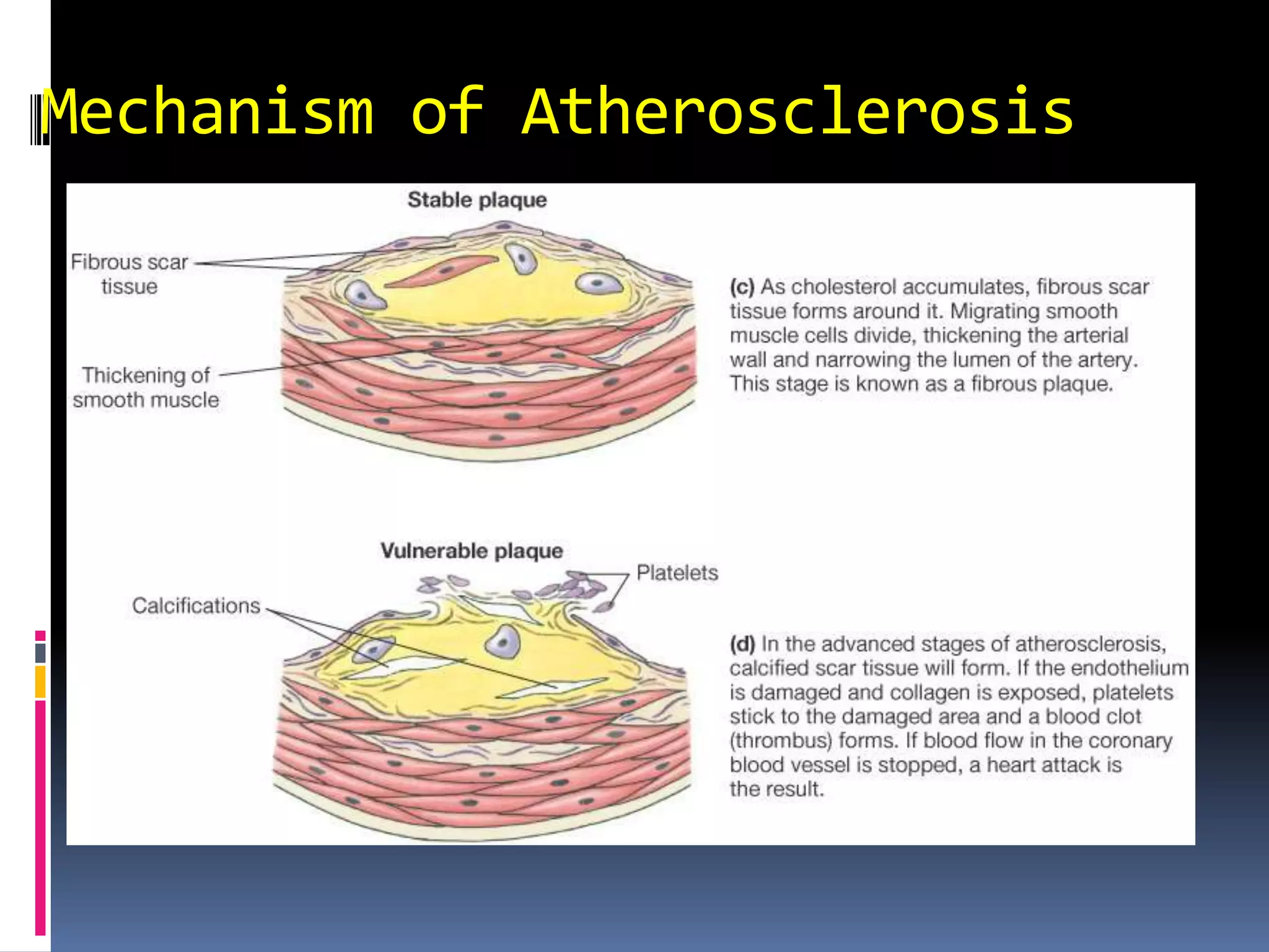 Mechanism of Atherosclerosis