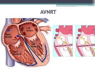 Lec 6 ECG.pptx