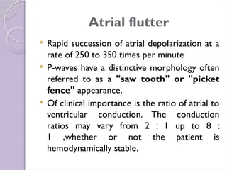 Lec 6 ECG.pptx cardiopulmonary physical therapy | PPTX
