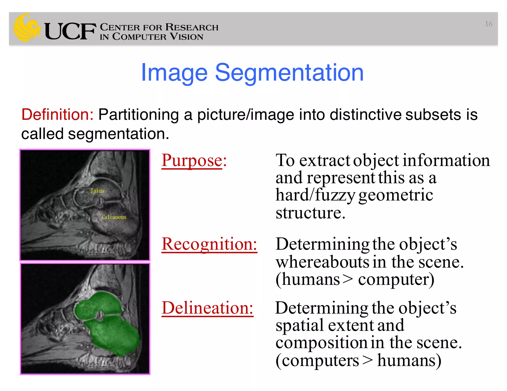 Lec7: Medical Image Segmentation (I) (Radiology Applications of ...