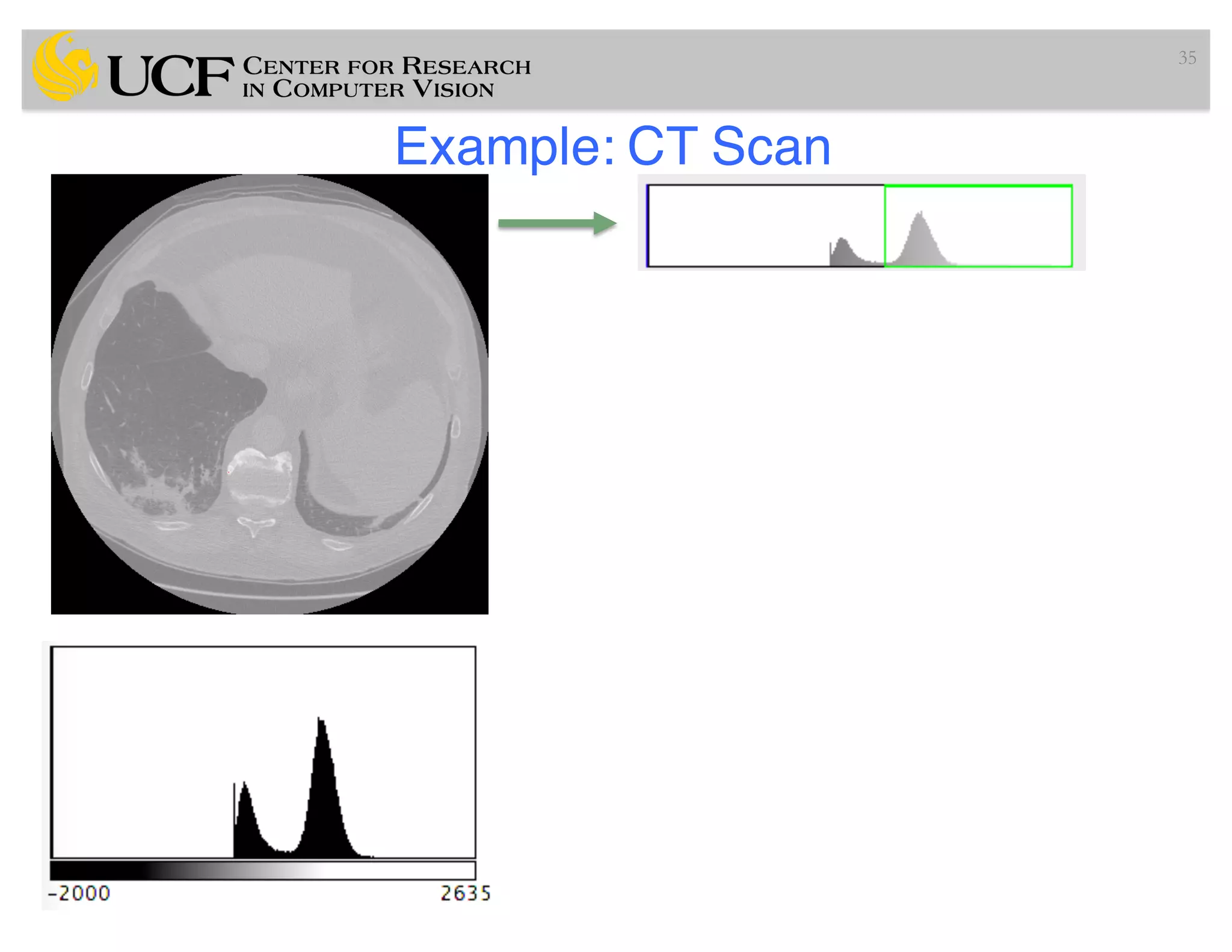 Example: CT Scan
35
 