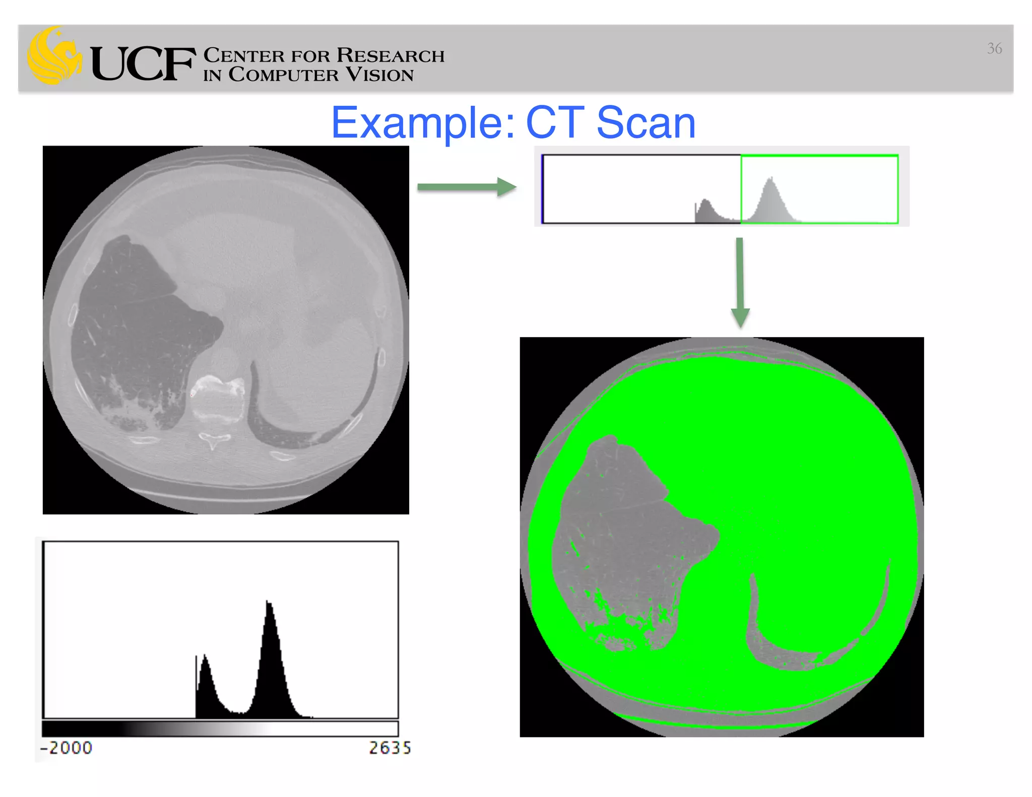 Example: CT Scan
36
 