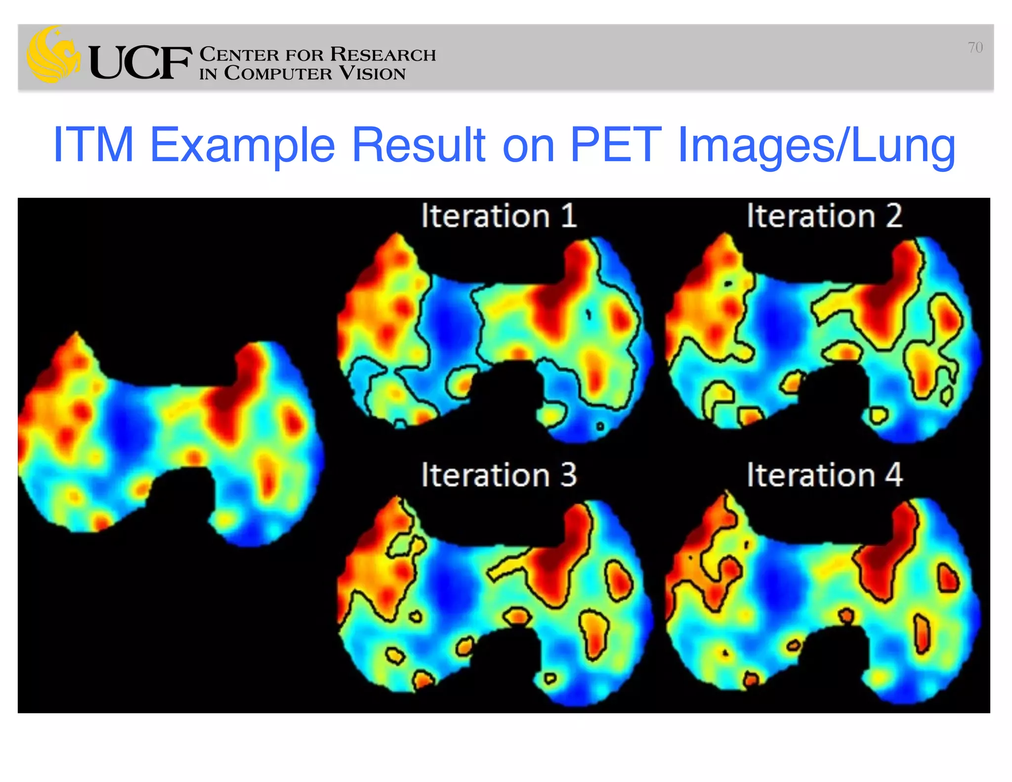 ITM Example Result on PET Images/Lung
70
 